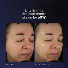 Load image into Gallery viewer, PCA SKIN Pro-Max Age Renewal
