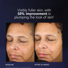 Load image into Gallery viewer, PCA SKIN Pro-Max Age Renewal
